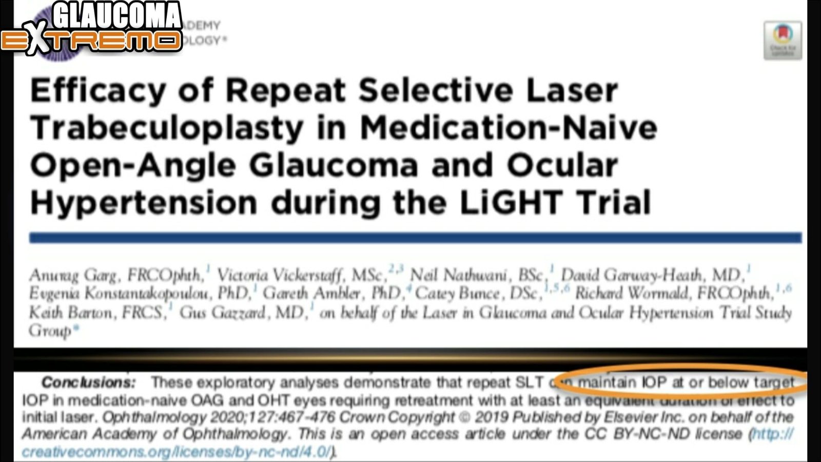 Facoextrema On Demand - Glaucoma